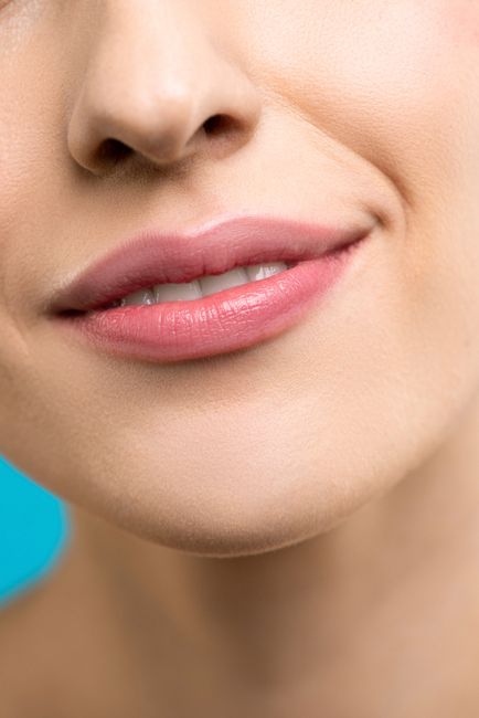 Lip Filler