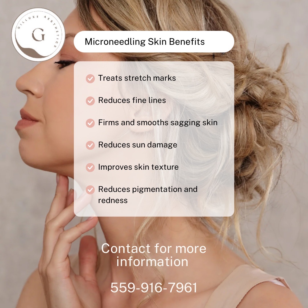 Microneedling