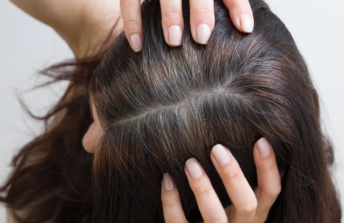 Root Touch-Up