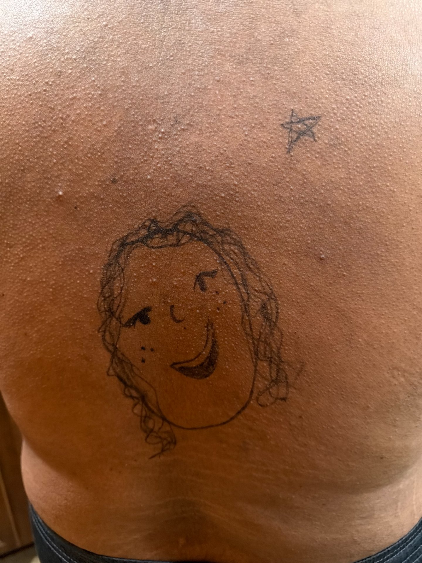 Back Sculpt & Smoothing Treatment