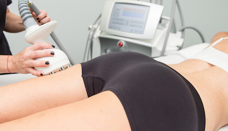 Back Sculpt & Smoothing Treatment