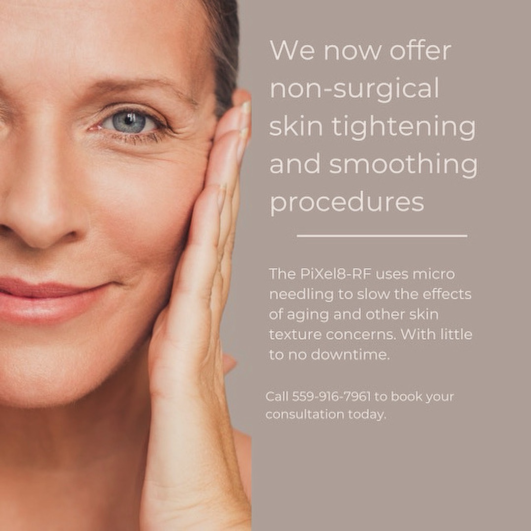 Microneedling